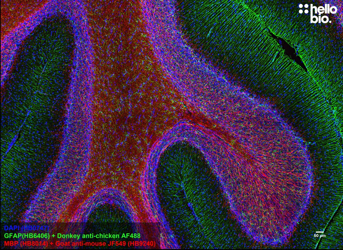 Figure 2. MBP staining in rat cerebellum using HB9240 Goat Anti-Mouse IgG H&L (Janelia Fluor&reg; 549) preadsorbed secondary antibody.