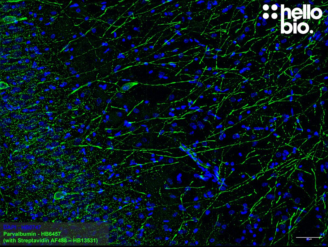Figure 4: Parvalbumin expressing interneurons in the rat hippocampus
