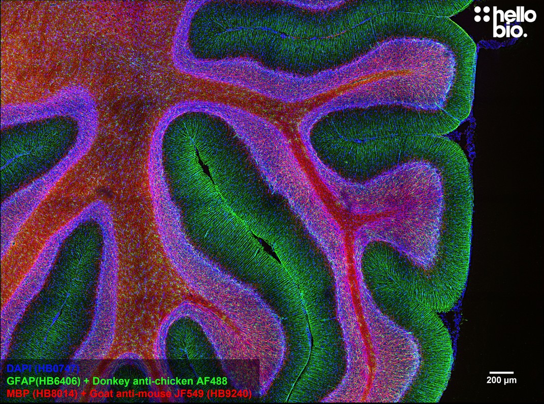 Figure 5. MBP staining in rat cerebellum using HB9240 Goat Anti-Mouse IgG H&L (Janelia Fluor&reg; 549) preadsorbed secondary antibody.