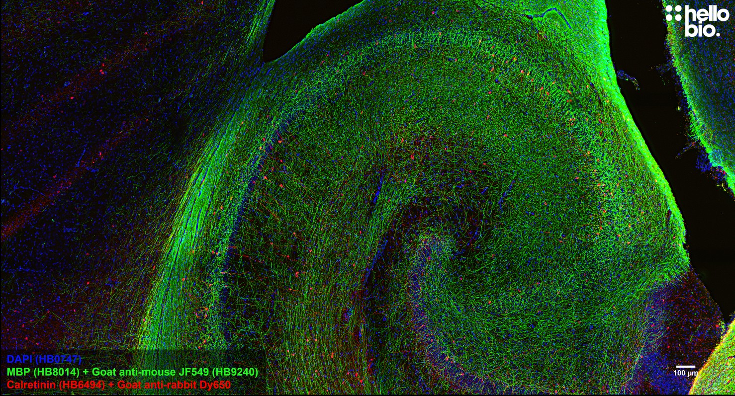 Figure 6. MBP staining in rat hippocampus using HB9240 Goat Anti-Mouse IgG H&L (Janelia Fluor&reg; 549) preadsorbed secondary antibody.