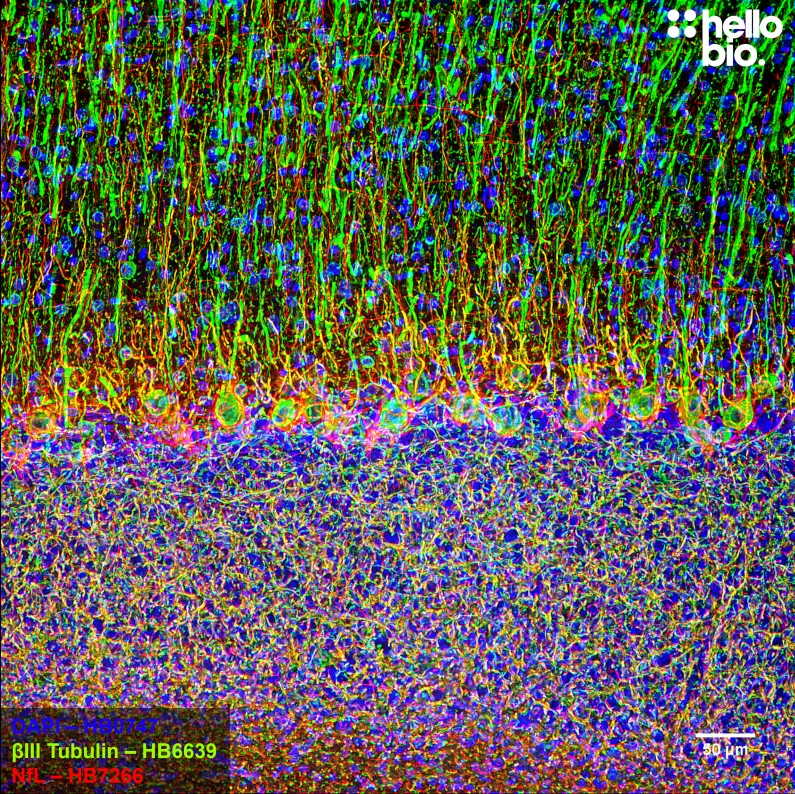 Figure 8. βIII-tubulin and Neurofilament light staining in rat cerebellum. Mounted using MightyMount<sup>TM</sup> Antifade Fluorescence Mounting Medium (aqueous).