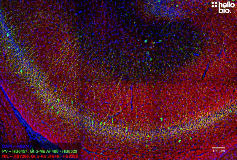 Figure 7. Neurofilament L and Parvalbumin staining in rat hippocampus using HB8283 Goat Anti-Rabbit H&L (Janelia Fluor&reg; 646) and HB8529 Goat Anti-Mouse H&L (AF488)