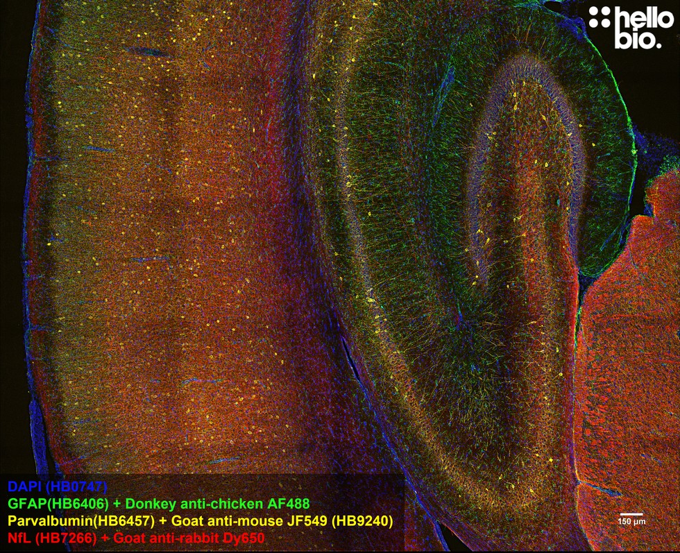 Figure 7. Parvalbumin staining in rat hippocampus and cortex using HB9240 Goat Anti-Mouse IgG H&L (Janelia Fluor&reg; 549) preadsorbed secondary antibody.