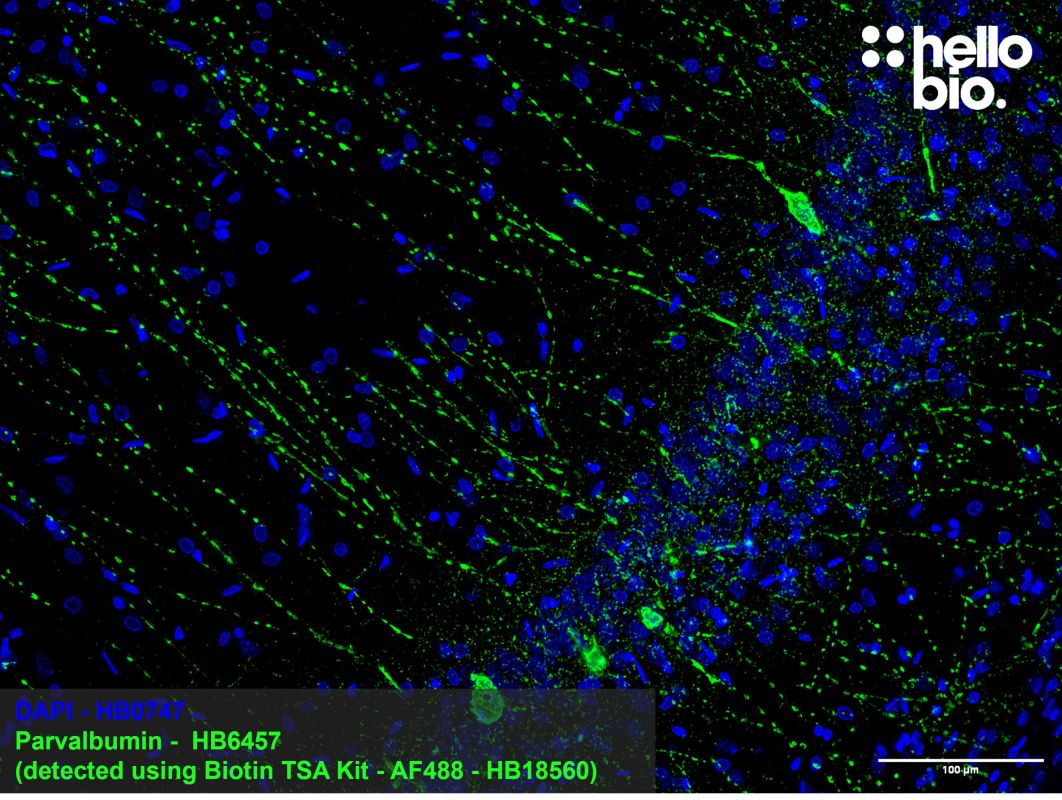 Figure 2: Parvalbumin positive neurons in the rat hippocampus, detected using biotin tyramide signal amplification