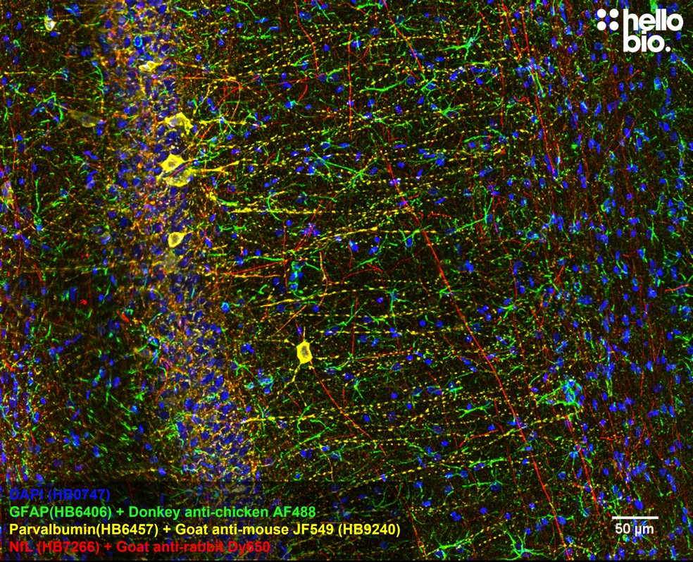 Figure 8. Parvalbumin staining in rat CA1 using HB9240 Goat Anti-Mouse IgG H&L (Janelia Fluor&reg; 549) preadsorbed secondary antibody.