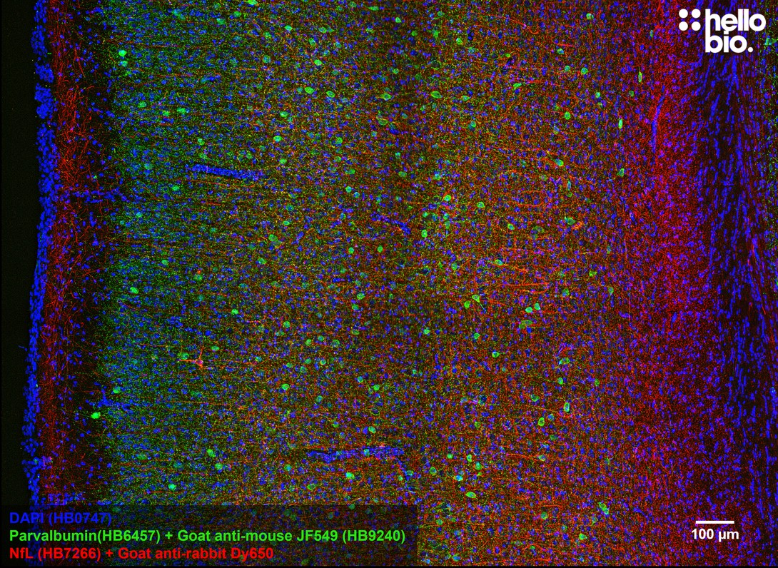 Figure 9. Parvalbumin staining in rat cortex using HB9240 Goat Anti-Mouse IgG H&L (Janelia Fluor&reg; 549) preadsorbed secondary antibody.