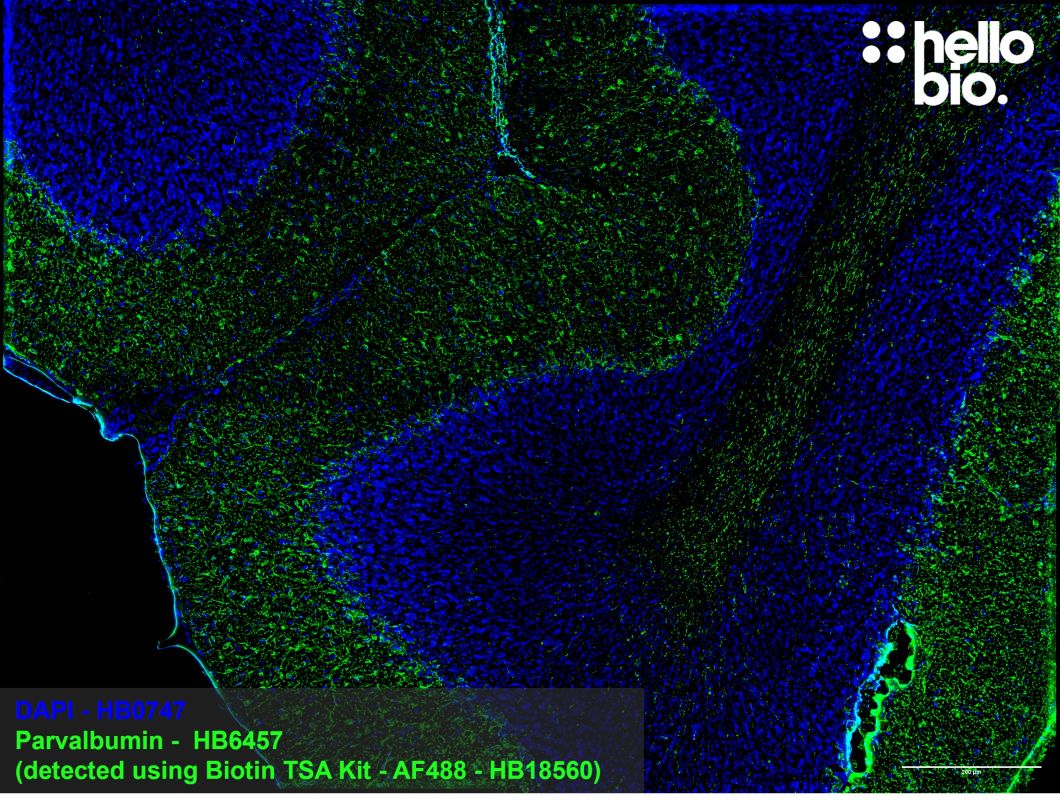 Figure 4: Parvalbumin expression in the rat cerebellum using tyramide signal amplification