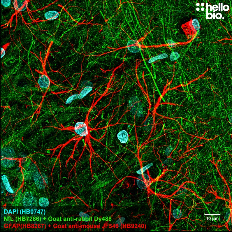 Figure 1. GFAP staining using HB9240 Goat Anti-Mouse IgG H&L (Janelia Fluor&reg; 549) preadsorbed secondary antibody.