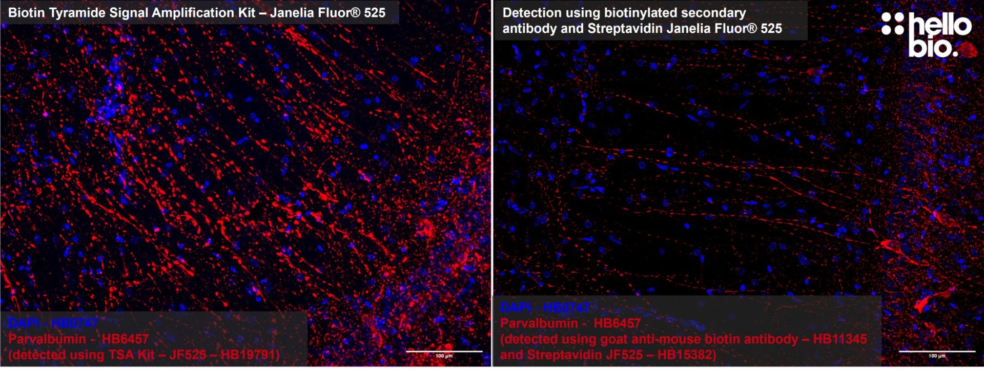 Figure 1: Tyramide Signal Amplification compared to detection using secondary biotin antibody and streptavidin
