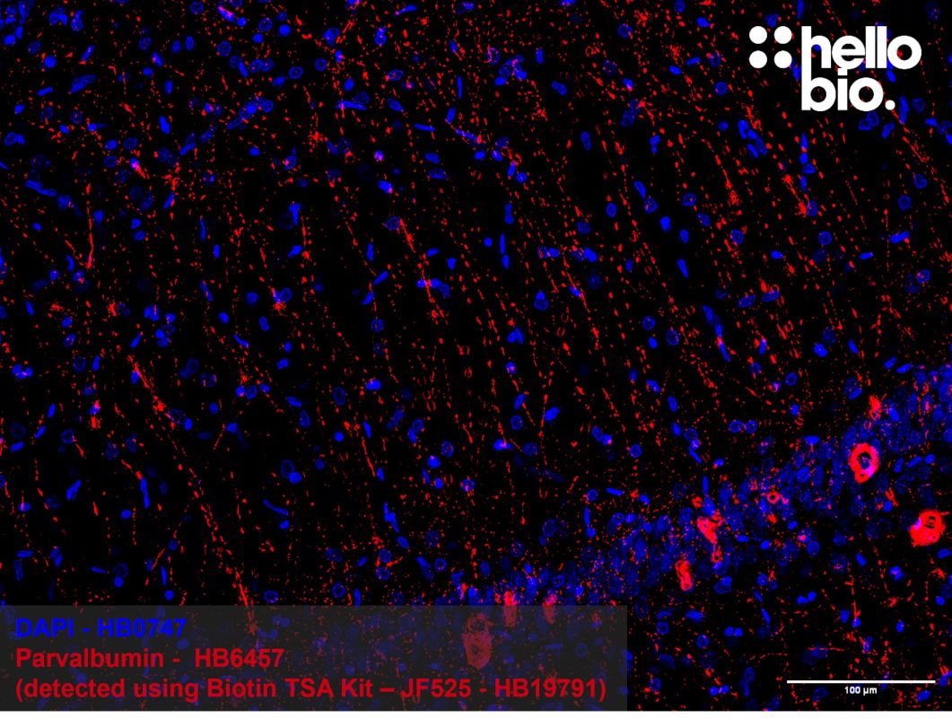 Figure 3: Parvalbumin positive neurons in the rat hippocampus, detected using tyramide signal amplification
