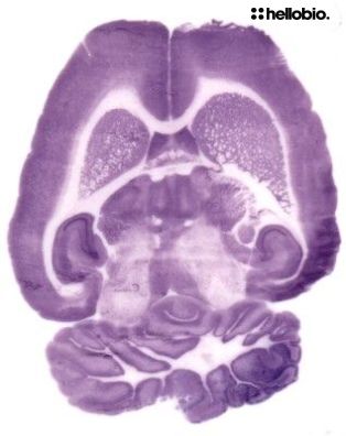 Figure 1. Histoblot for NeuN in rat brain using NBT/BCIP for detection. 