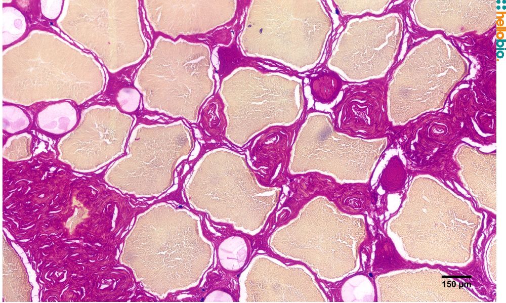 Figure. 5: Picro Sirius red staining in toad skin. 