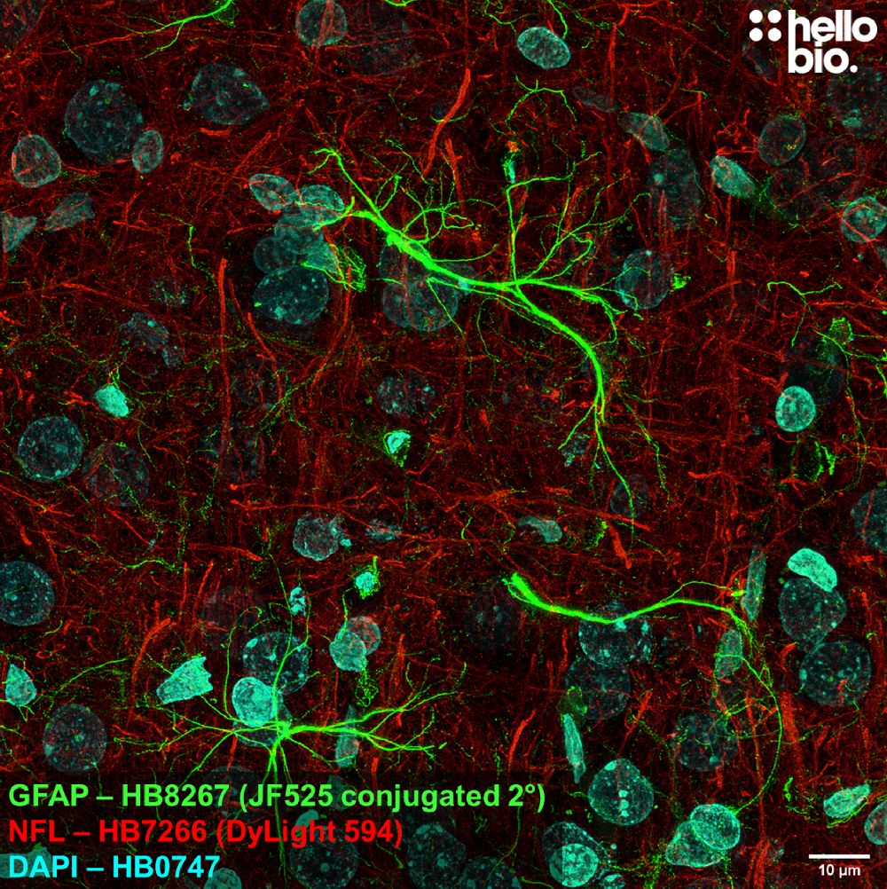 Fig 3. GFAP expression in rat brain visualised using a Janelia Fluor® 525 conjugated secondary antibody. 