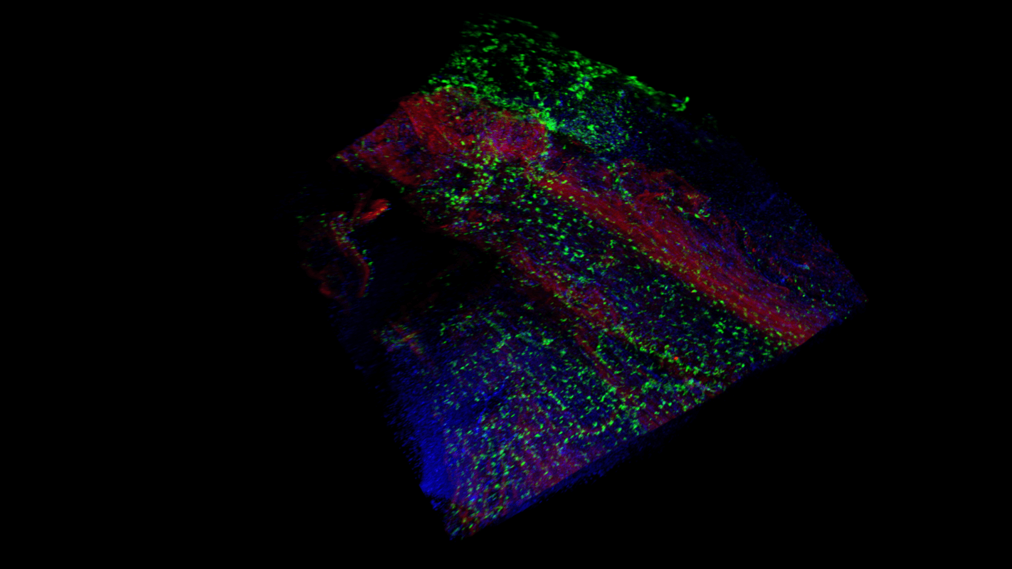 Figure 4. Cleared rat hippocampus stained for GFAP and Neurofilament L