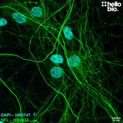 Anti-Neurofilament L (NF-L) antibody ValidAb Neurofilament L